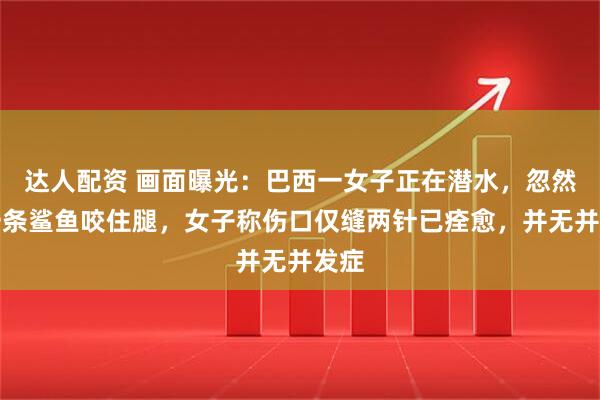 达人配资 画面曝光：巴西一女子正在潜水，忽然被一条鲨鱼咬住腿，女子称伤口仅缝两针已痊愈，并无并发症